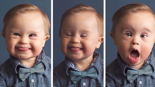 Boy with Down syndrome stars in photoshoot after casting call rejection