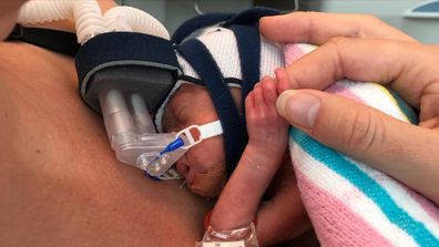 Little Rafferty spent three months in NICU at the Mater Mothers' Brisbane Hospital
