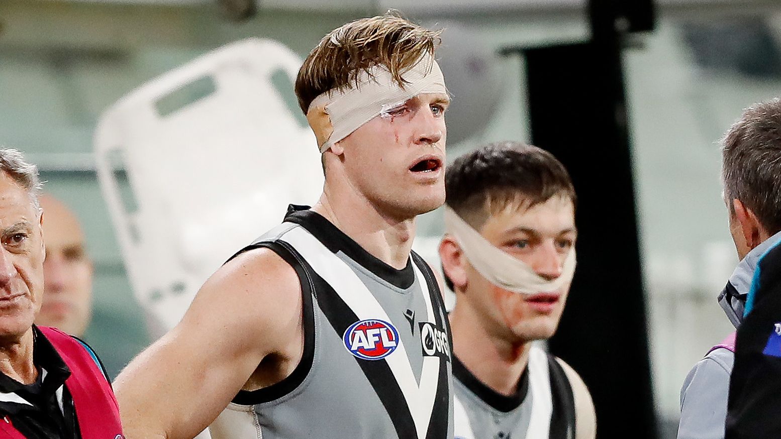 Ken Hinkley supports doctor's concussion verdict after sickening clash