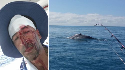 Oliver Galea suffered a deep head laceration when a whale struck his boat.(Facebook)
