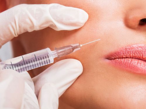 Wife horrified after husband told her to get botox