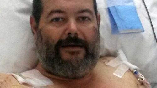 'They were out to kill': NSW man played dead to survive savage dog attack