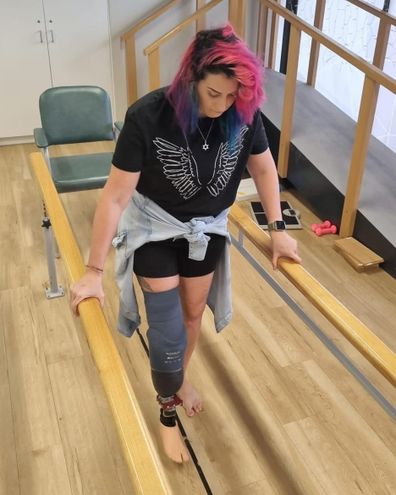 Lucy Wolfman walking after undergoing an amputation.