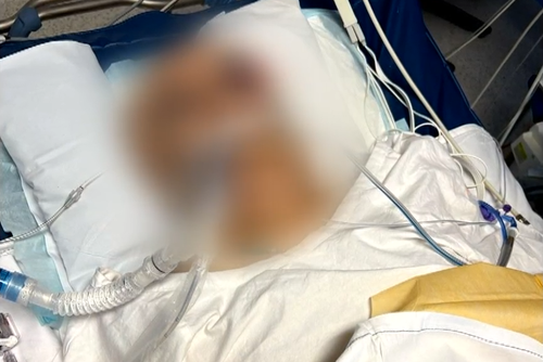 Man hit by car in Mount Pritchard in Sydney's south-west
