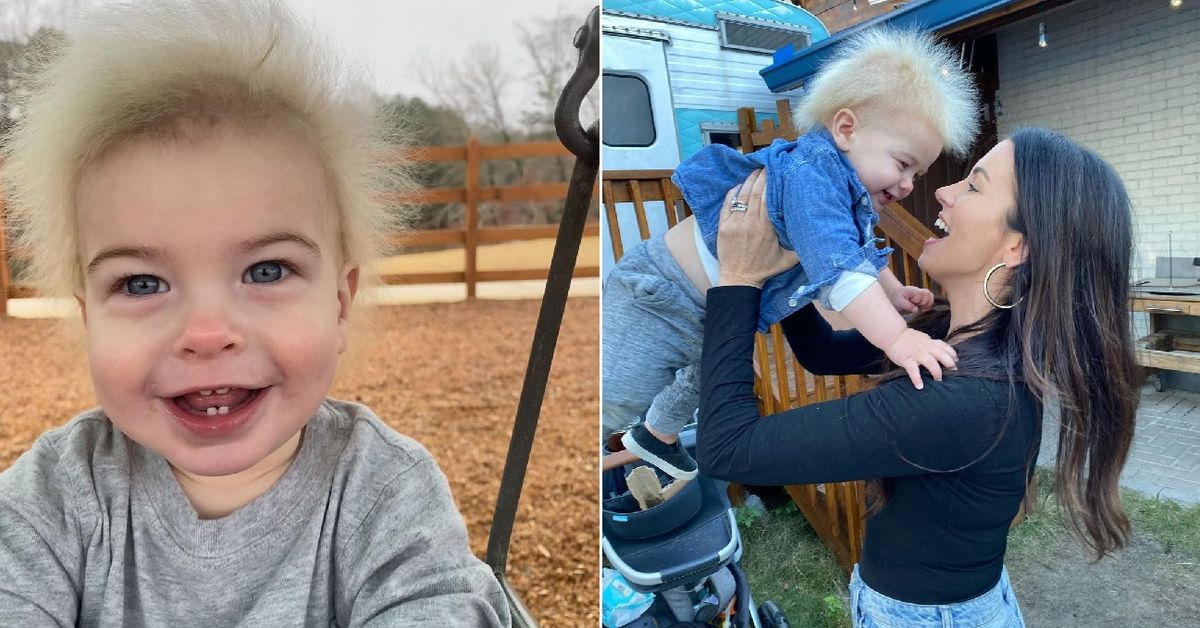 Toddler Diagnosis: Toddler is one of 100 people in the world diagnosed with  rare uncombable hair syndrome - 9Honey