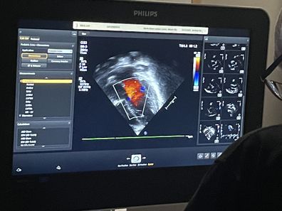 Fortunately, the first echocardiogram was normal.
