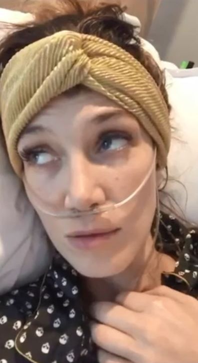 Delta Goodrem had surgery in October 2018 to remove the salivary gland