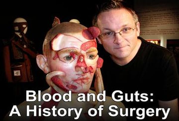 Blood and Guts: A History of Surgery