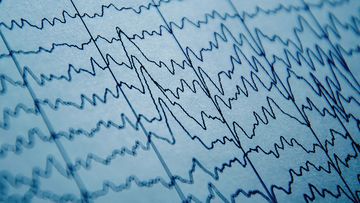 EEG recordings showed increased levels of gamma rays in certain parts of the brain as people had cardiac arrests.