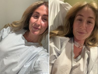 Mikaela Gangi before and after her second cancer surgery.