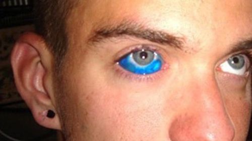 NSW government lashed over eyeball tattoo laws