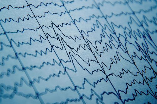 EEG recordings showed increased levels of gamma rays in certain parts of the brain as people had cardiac arrests.