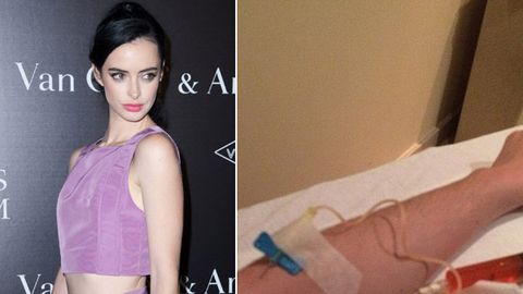 Breaking Bad's Krysten Ritter sparks outrage with intravenous vitamin drip photo