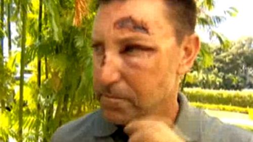 Robert Allenby with the injuries he sustained on January 16 in Hawaii.