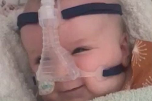 Mackenzie Casella was a much loved baby girl who didn't make it to her first birthday after being diagnosed with spinal muscular atrophy (SMA).