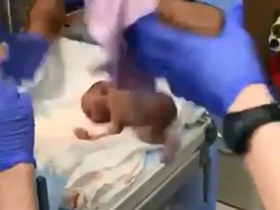 Baby girl accidentally dropped on her head by doctors