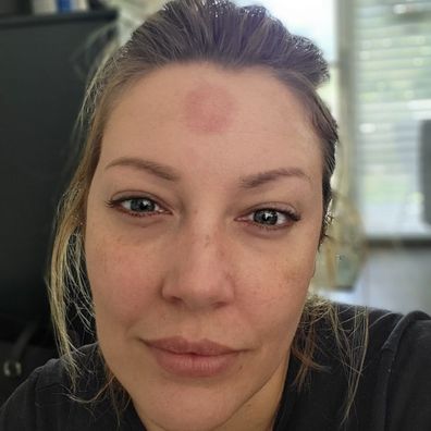Sydney mum Nikki Smith reveals hilarious 'suction cup hickey' from kids toy.
