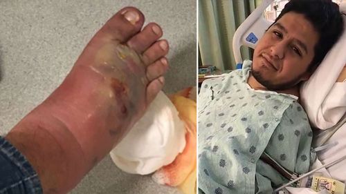 Mr Reyes was rushed to hospital after noticing his foot had started to swell.  