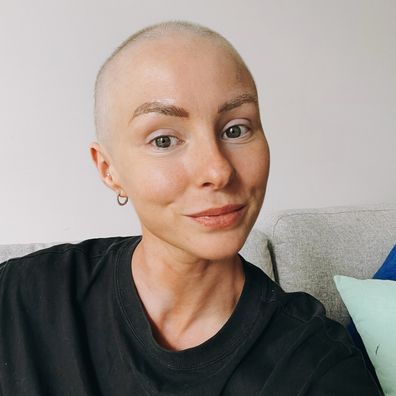 Rachael lost her hair while going through cancer treatment.