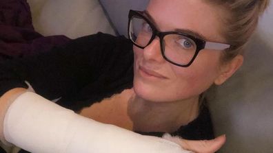 Erin Molan fractured hand