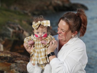 Mum Debb with baby Daisy who was born with Apert Syndrome