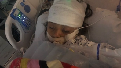 Aurea Soto Morales fell into a coma after suffering brain swelling.