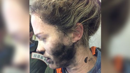 Aussie woman's headphones explode during flight
