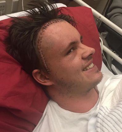 Johnny Ruffo gives update on cancer battle. 'Still fighting' five years on.