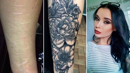 Brisbane woman inundated with requests after offering to tattoo people’s scars for free