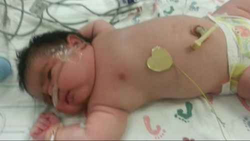 Baby Mia Hernandez shocked doctors and nurses at a Colorado hospital when she tipped the scales at close to 6kg. (Supplied)