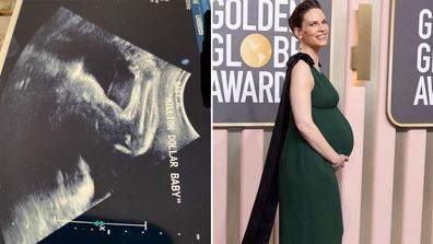 Hilary Swank shares incredible ultrasound photo of twins