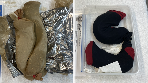 Lizards wrapped in socks and pantyhose to be smuggled.
