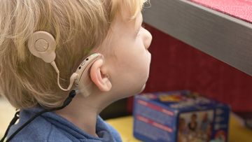 File image: Cochlear Implant