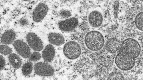 This electron microscopic (EM) image depicted a monkeypox virion, obtained from a clinical sample associated with the 2003 prairie dog outbreak. It was a thin section image from of a human skin sample. On the left were mature, oval-shaped virus particles, and on the right were the crescents, and spherical particles of immature virions. High Resolution:	Click here for hi-resolution image (5.21 MB) Content Providers(s):	CDC/ Cynthia S. Goldsmith Creation Date:	2003 Photo Credit:	Cynthia S. Goldsmi