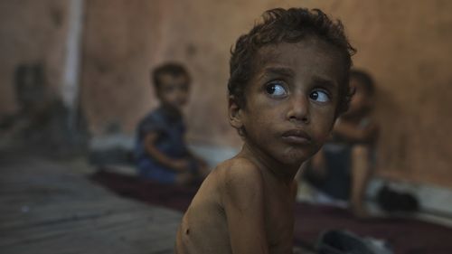 Yazan Abu Ful, a 2-year-old malnourished child, sits at his family home in the Shati refugee camp in Gaza City on Wednesday, July 23, 2025. (AP Photo/Jehad Alshrafi)