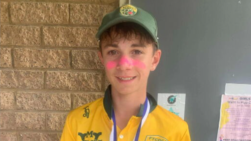 Aï»¿ teenage cricketer who was injured in a training accident in Melbourne on Tuesday has died, his club has revealed. Ben Austin, 17, ï»¿was batting in the nets when he was hit in the head and neck area by a ball.