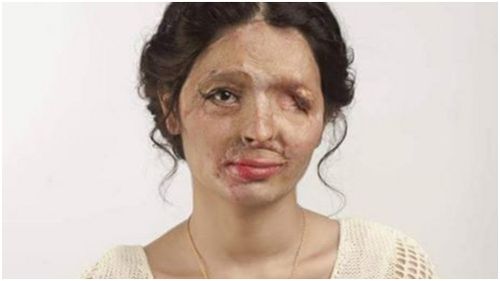 Acid attack survivor to walk runway at fashion week in New York City