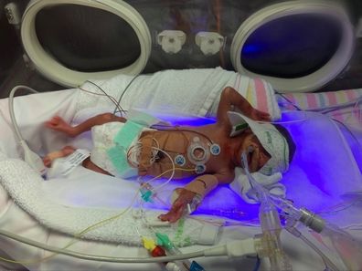 Jibreel was born at just 25 weeks gestation and was about the size of a coke can.