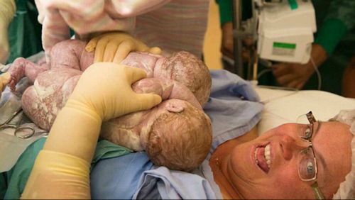 She said holding both girls after the birth was "amazing". (Simone Harvey, Simone's Photography)