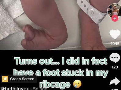 Bethany Love shares photo of baby's misshapen feet that were stuck under her rib cage 