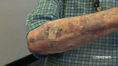 Mr Giles was left bruised and battered. (9NEWS)