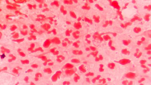 File image of meningococcal disease under the microscope. (iStock)