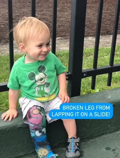 The mum revealed her toddler son broke his leg while going down the slide with her