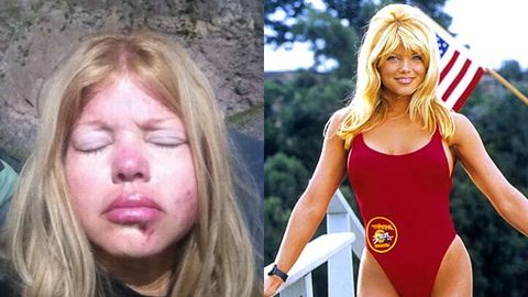 Ex-Baywatch star Donna D'Errico reveals battered face after 'major fall' during search for Noah's Ark