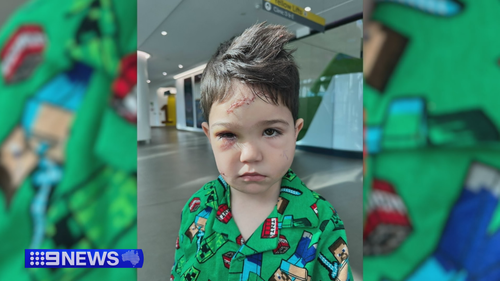 Perth mum's 'living nightmare' after four-year-old attacked by dog