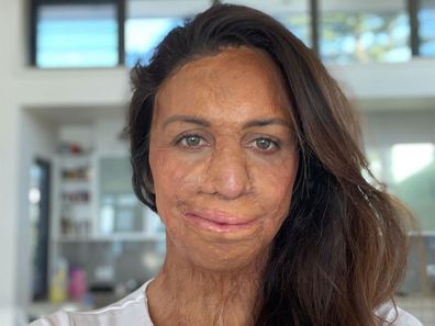 Turia Pitt