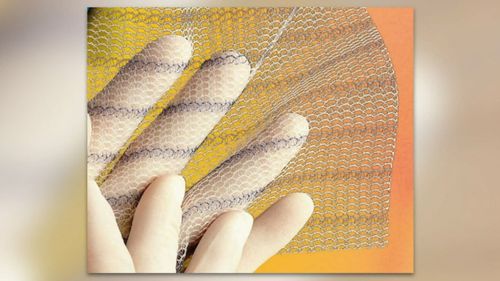 A class action lawsuit has been launched after hundreds of women claimed a mesh implant gave them excruciating pain.