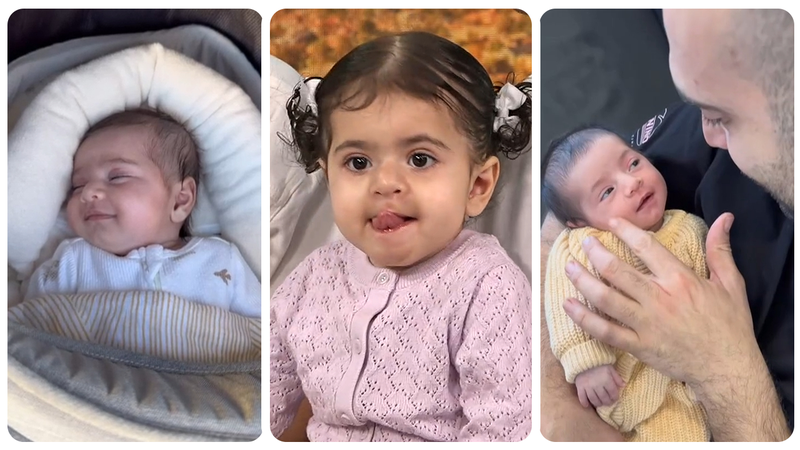 Two-year-old Australian toddler Valentina is living with Hyaline Fibromatosis Syndrome