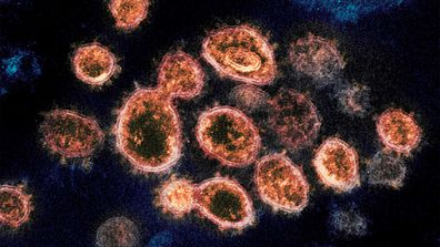 Coronavirus seen under the microscope.