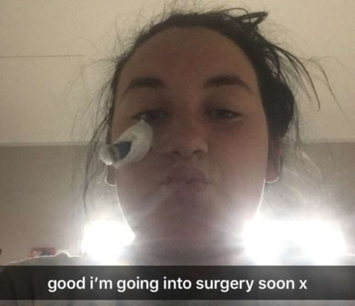 Candi sent this Snapchat before her operation.